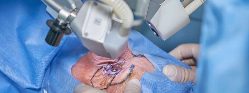 eye-laser-surgery-5016073_1280